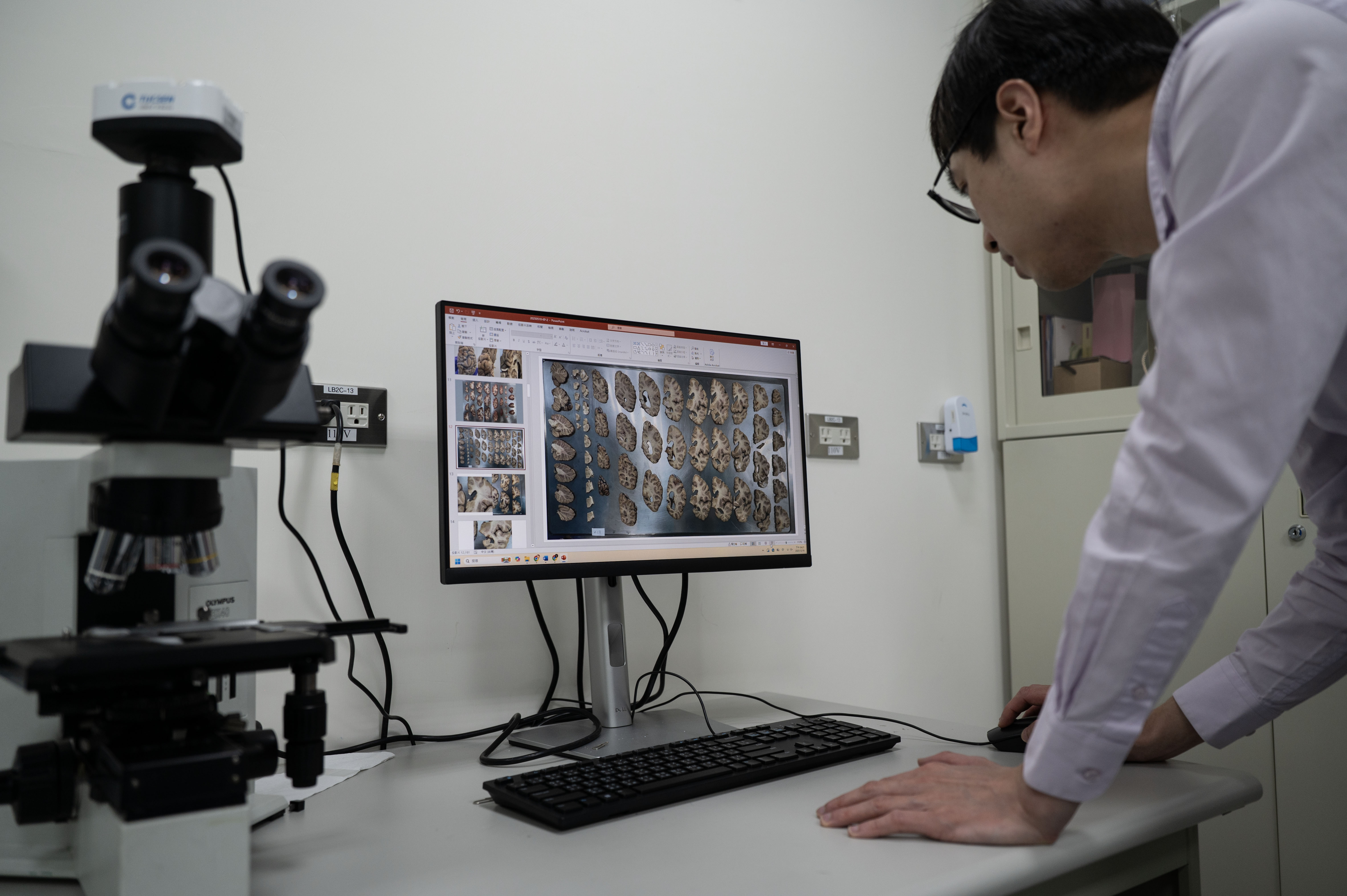 張克平醫師正在判讀大腦切片病理，試圖解開疾病的謎題。（攝影／楊子磊）